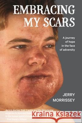 Embracing My Scars: A journey of hope in the face of adversity Jerry Morrissey 9781763639102 Jerry Morrissey - książka