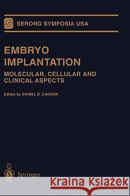 Embryo Implantation: Molecular, Cellular and Clinical Aspects Carson, Daniel D. 9780387988061 Springer - książka