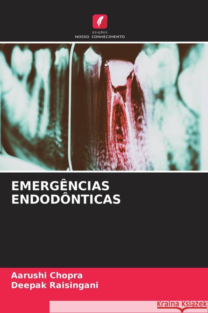EMERGÊNCIAS ENDODÔNTICAS Chopra, Aarushi, Raisingani, Deepak 9786205540503 Edições Nosso Conhecimento - książka