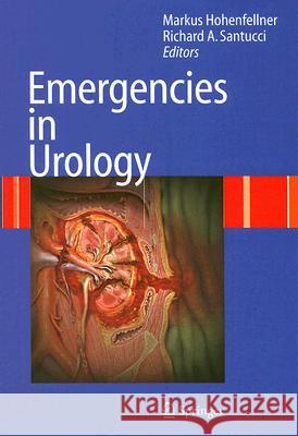 Emergencies in Urology M. Hohenfellner R. A. Santucci 9783540486039 Springer - książka