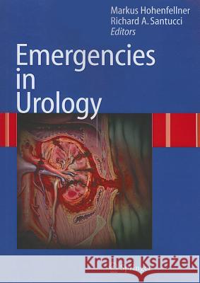Emergencies in Urology M. Hohenfellner R. a. Santucci 9783642080197 Not Avail - książka