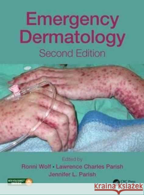 Emergency Dermatology Ronni Wolf Lawrence Charles Parish Jennifer L. Parish 9781498729314 CRC Press - książka