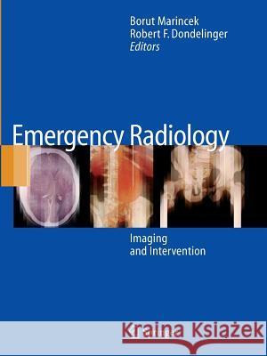 Emergency Radiology: Imaging and Intervention Marincek, Borut 9783642065682 Not Avail - książka