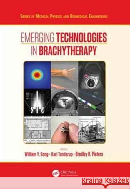 Emerging Technologies in Brachytherapy William Y. Song Kari Tanderup Bradley Pieters 9781498736527 CRC Press - książka