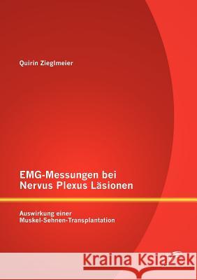 EMG-Messungen bei Nervus Plexus Läsionen: Auswirkung einer Muskel-Sehnen-Transplantation Zieglmeier, Quirin 9783842874053 Diplomica Verlag Gmbh - książka