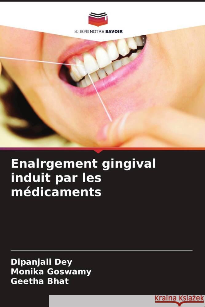 Enalrgement gingival induit par les médicaments Dey, Dipanjali, Goswamy, Monika, Bhat, Geetha 9786204573144 Editions Notre Savoir - książka