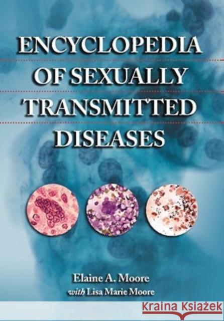 Encyclopedia of Sexually Transmitted Diseases Elaine A. Moore Lisa M. Moore Marvin G. Miller 9780786443178 McFarland & Company - książka