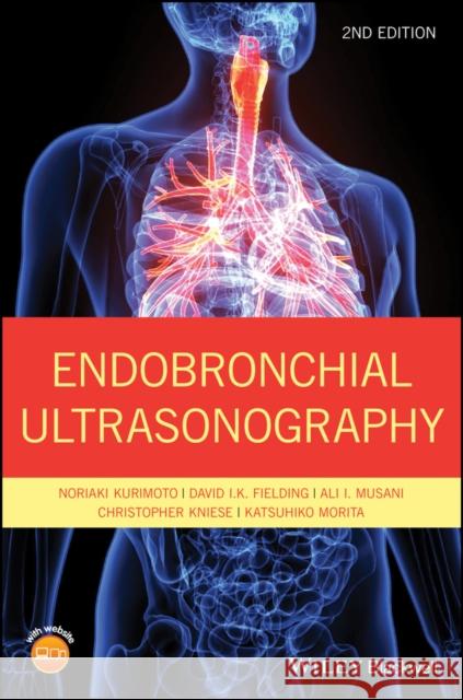 Endobronchial Ultrasonography Noriaki Kurimoto David Fielding Ali Musani 9781119233947 Wiley-Blackwell - książka