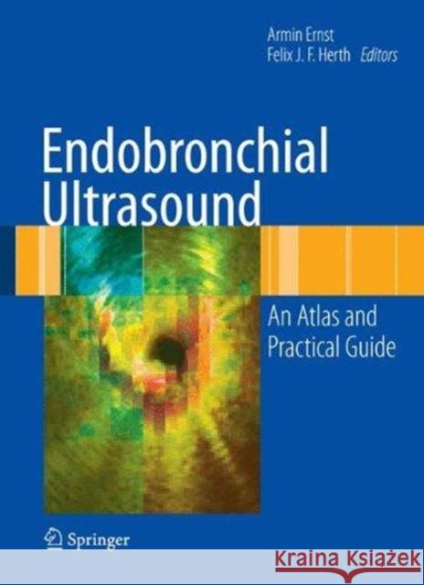 Endobronchial Ultrasound: An Atlas and Practical Guide Ernst, Armin 9781493939176 Springer - książka