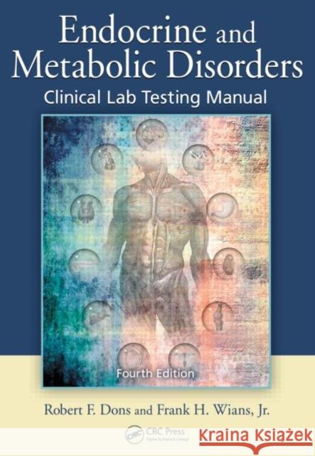 Endocrine and Metabolic Disorders: Clinical Lab Testing Manual Dons, Robert F. 9781420079326 TAYLOR & FRANCIS LTD - książka