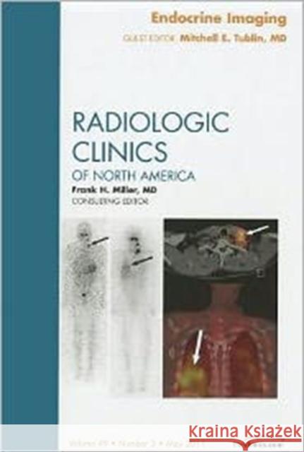 Endocrine Imaging, an Issue of Radiologic Clinics of North America: Volume 49-3 Tublin, Mitchell E. 9781455711499 W.B. Saunders Company - książka