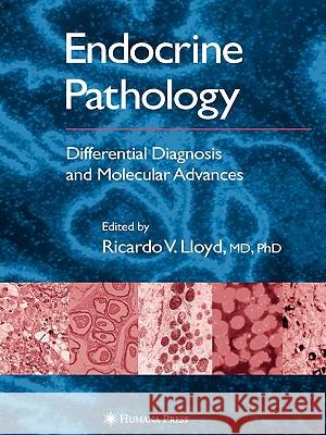 Endocrine Pathology: Differential Diagnosis and Molecular Advances Lloyd, Ricardo V. 9781617374234 Springer - książka