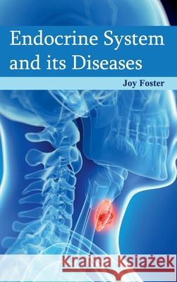 Endocrine System and Its Diseases Joy Foster 9781632421760 Foster Academics - książka