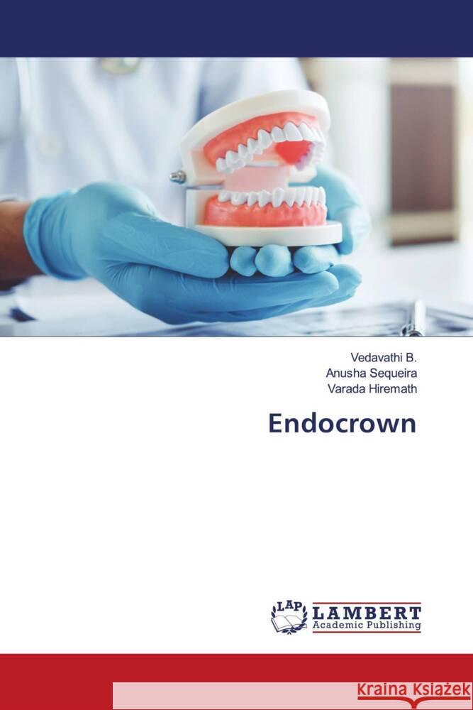 Endocrown B., Vedavathi, Sequeira, Anusha, Hiremath, Varada 9786208118686 LAP Lambert Academic Publishing - książka