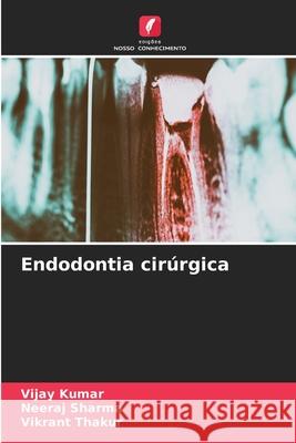 Endodontia cir?rgica Vijay Kumar Neeraj Sharma Vikrant Thakur 9786207670550 Edicoes Nosso Conhecimento - książka