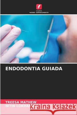 ENDODONTIA GUIADA MATHEW, TREESA, Lokhande, Nitin 9786208711153 Edições Nosso Conhecimento - książka