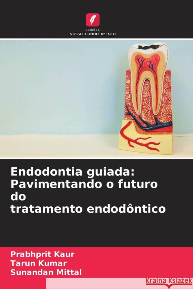 Endodontia guiada: Pavimentando o futuro do tratamento endodôntico Kaur, Prabhprit, Kumar, Tarun, Mittal, Sunandan 9786208192662 Edições Nosso Conhecimento - książka