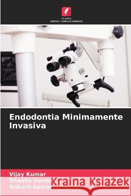 Endodontia Minimamente Invasiva Vijay Kumar Shweta Verma Ankush Kumar 9786206031598 Edicoes Nosso Conhecimento - książka