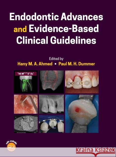 Endodontic Advances and Evidence-Based Clinical Guidelines  9781119553885 John Wiley and Sons Ltd - książka