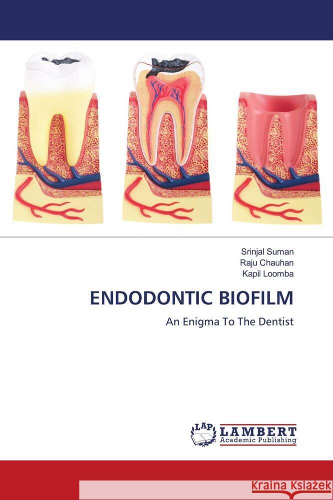 ENDODONTIC BIOFILM Suman, Srinjal, Chauhan, Raju, Loomba, Kapil 9786204740652 LAP Lambert Academic Publishing - książka