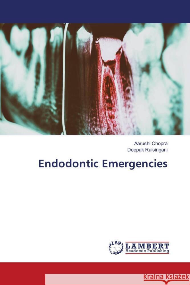 Endodontic Emergencies Chopra, Aarushi, Raisingani, Deepak 9786205526040 LAP Lambert Academic Publishing - książka
