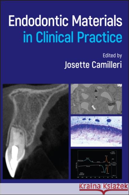 Endodontic Materials in Clinical Practice Josette Camilleri 9781119513520 Wiley-Blackwell - książka