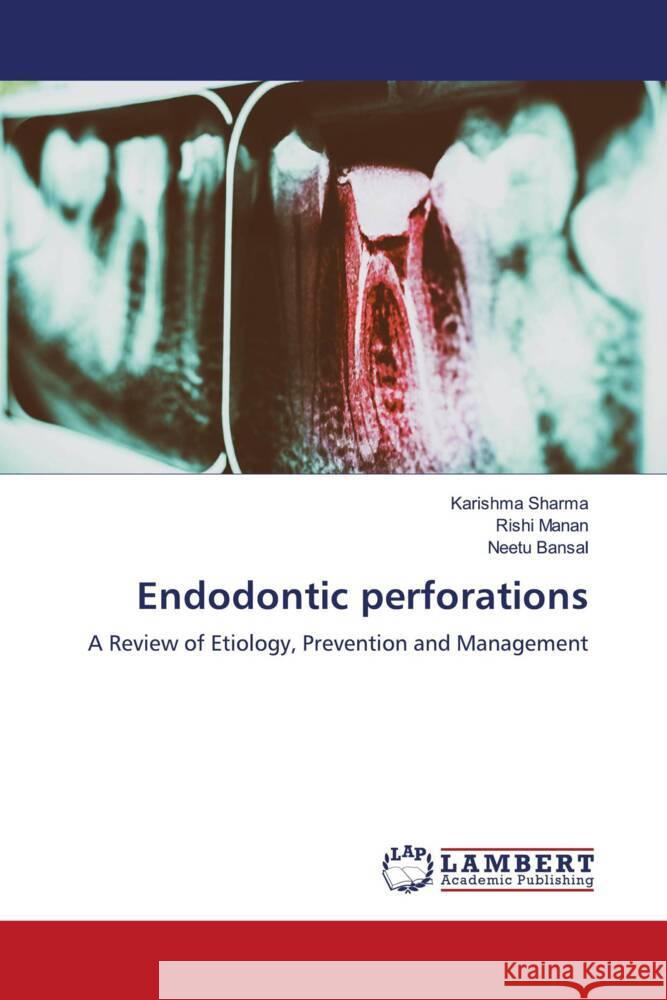 Endodontic perforations Sharma, Karishma, Manan, Rishi, Bansal, Neetu 9786204730301 LAP Lambert Academic Publishing - książka