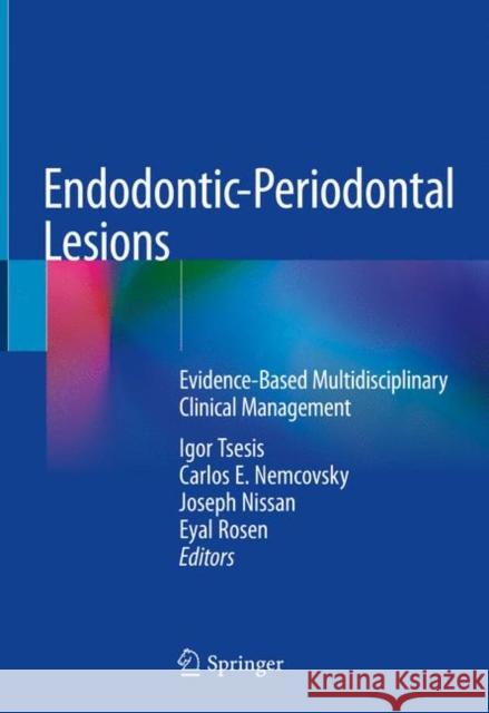 Endodontic-Periodontal Lesions: Evidence-Based Multidisciplinary Clinical Management Tsesis, Igor 9783030107246 Springer - książka