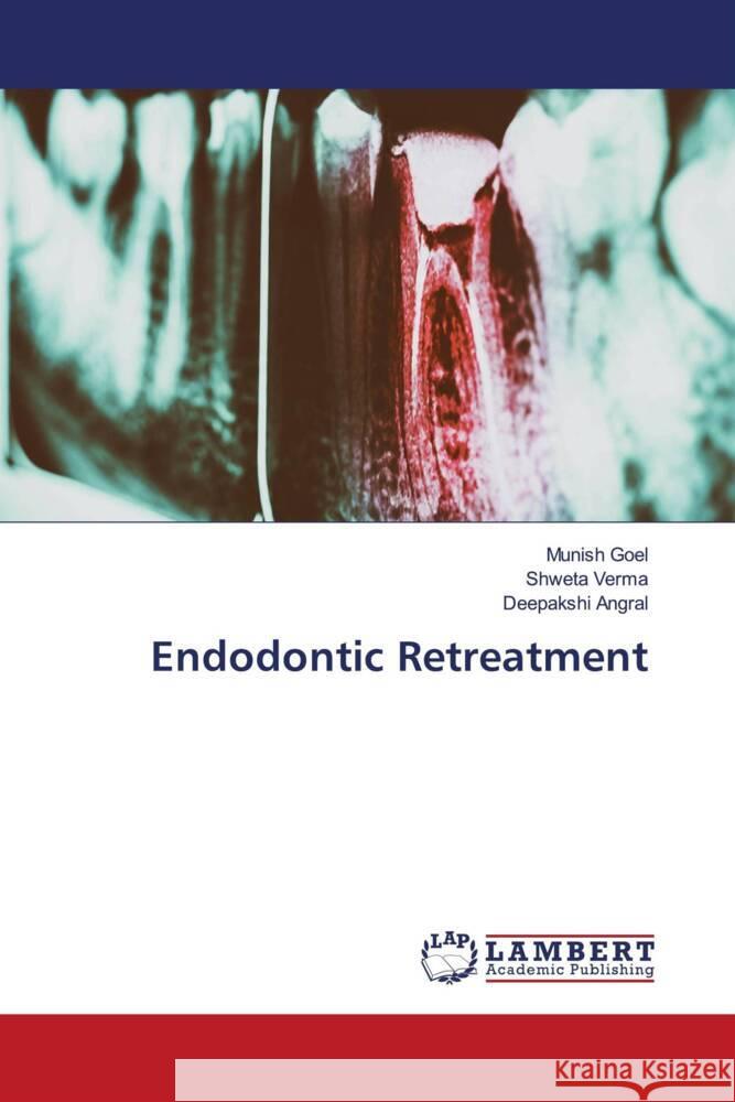 Endodontic Retreatment Goel, Munish, Verma, Shweta, Angral, Deepakshi 9786205490112 LAP Lambert Academic Publishing - książka