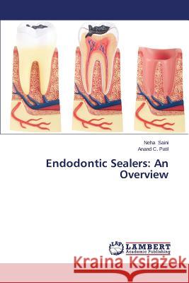 Endodontic Sealers: An Overview Saini Neha                               Patil Anand C. 9783659578755 LAP Lambert Academic Publishing - książka