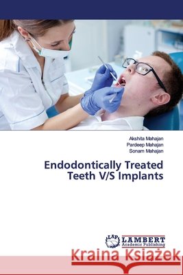 Endodontically Treated Teeth V/S Implants Mahajan, Akshita; Mahajan, Pardeep; Mahajan, Sonam 9786139448487 LAP Lambert Academic Publishing - książka