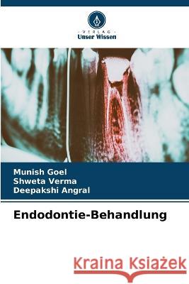 Endodontie-Behandlung Munish Goel Shweta Verma Deepakshi Angral 9786205965726 Verlag Unser Wissen - książka