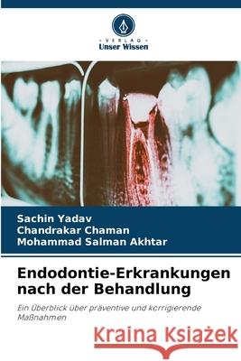 Endodontie-Erkrankungen nach der Behandlung Sachin Yadav Chandrakar Chaman Mohammad Salman Akhtar 9786207915934 Verlag Unser Wissen - książka