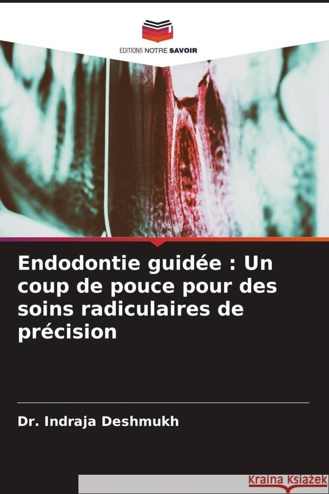 Endodontie guid?e: Un coup de pouce pour des soins radiculaires de pr?cision Indraja Deshmukh 9786208122058 Editions Notre Savoir - książka