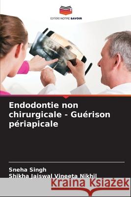 Endodontie non chirurgicale - Guérison périapicale Singh, Sneha, Vineeta Nikhil, Shikha Jaiswal 9786208944148 Editions Notre Savoir - książka