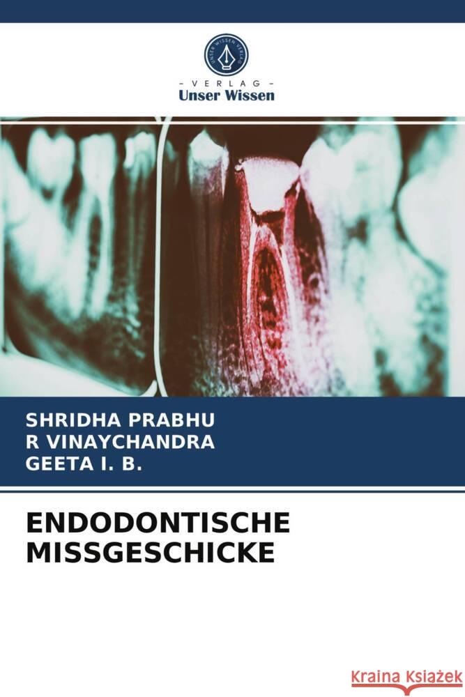 ENDODONTISCHE MISSGESCHICKE Prabhu, Shridha, Vinaychandra, R, I. B., Geeta 9786203964844 Verlag Unser Wissen - książka