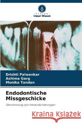 Endodontische Missgeschicke Drishti Palwankar Ashima Garg Monika Tandan 9786205869482 Verlag Unser Wissen - książka