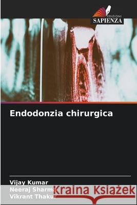 Endodonzia chirurgica Vijay Kumar Neeraj Sharma Vikrant Thakur 9786207670604 Edizioni Sapienza - książka