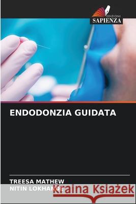 ENDODONZIA GUIDATA MATHEW, TREESA, Lokhande, Nitin 9786208711139 Edizioni Sapienza - książka
