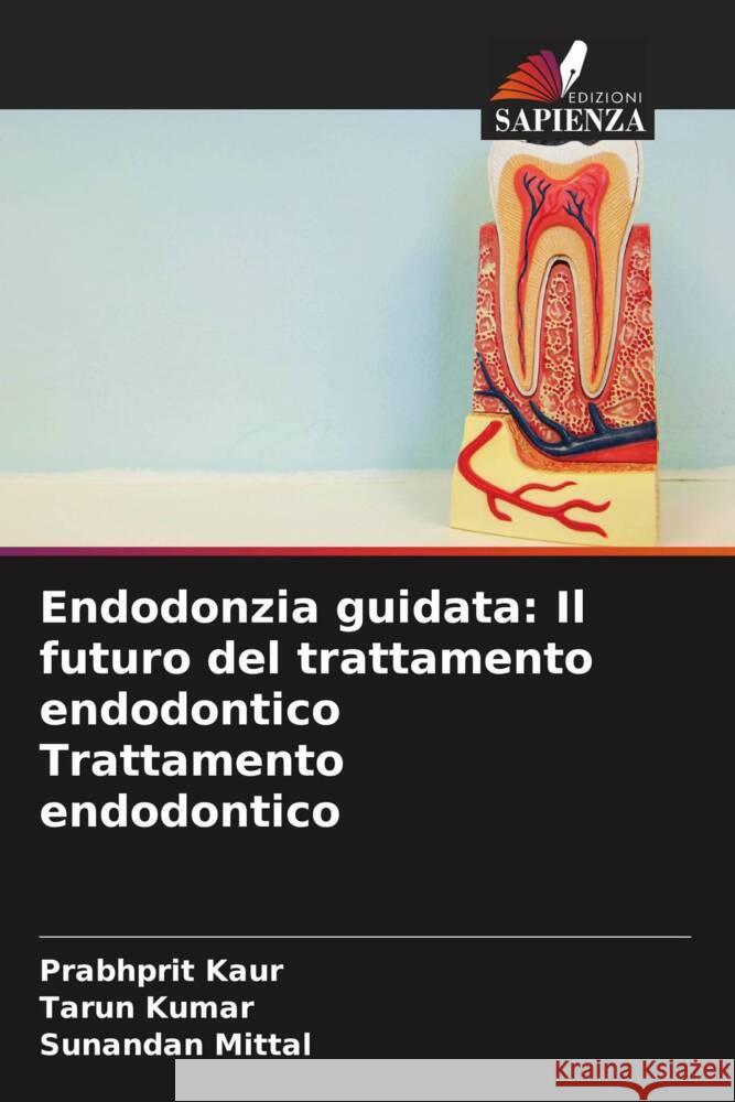 Endodonzia guidata: Il futuro del trattamento endodontico Trattamento endodontico Prabhprit Kaur Tarun Kumar Sunandan Mittal 9786208192686 Edizioni Sapienza - książka