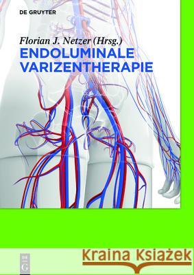 Endoluminale Varizentherapie Netzer, Florian Johannes 9783110352887 De Gruyter - książka