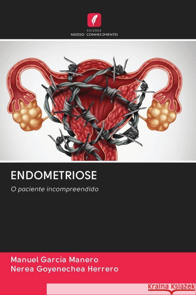 ENDOMETRIOSE García Manero, Manuel, Goyenechea Herrero, Nerea 9786202999076 Edicoes Nosso Conhecimento - książka