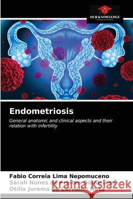 Endometriosis Fabio Correia Lim Sarah Nunes de Freitas Domiciano Ot 9786203511970 Our Knowledge Publishing - książka