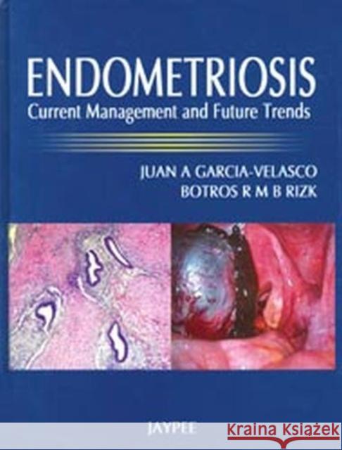 Endometriosis : Current Management and Future Trends Garcia-Velasco, Juan A. 9788184488081  - książka