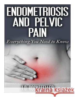 Endometriosis and Pelvic Pain: Everything You Need to Know J. D. Rockefeller 9781517249694 Createspace - książka