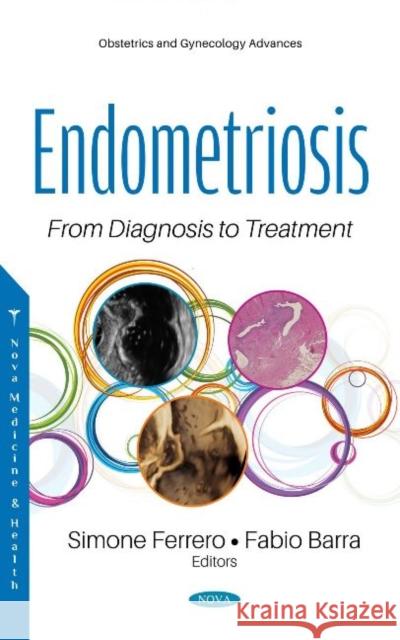 Endometriosis: From Diagnosis to Treatment Simone Ferrero, M.D., Ph.D.   9781536177466 Nova Science Publishers Inc - książka