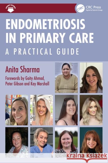 Endometriosis in Primary Care Anita Sharma 9781032684796 Taylor & Francis Ltd - książka