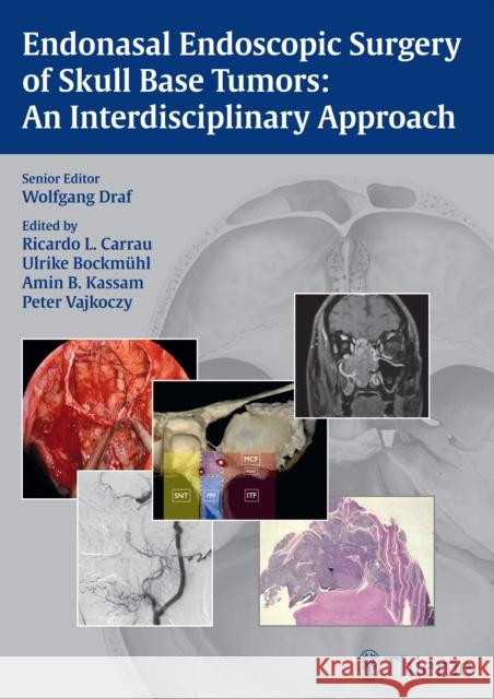 Endonasal Endoscopic Surgery of Skull Base Tumors: An Interdisciplinary Approach Draf, Wolfgang 9783131546715 Thieme Medical Publishers - książka