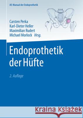 Endoprothetik Der H?fte Carsten Perka Karl-Dieter Heller Maximilian Rudert 9783662686164 Springer - książka