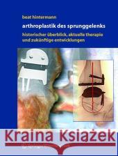 Endoprothetik des Sprunggelenks: Historischer Überblick, aktuelle Therapiekonzepte und Entwicklungen Beat Hintermann 9783211235867 Springer Verlag GmbH - książka